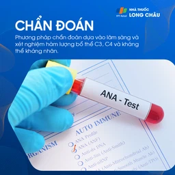Lupus ban đỏ 5