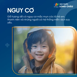 Mụn cóc 4