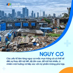 Mụn trứng cá 4