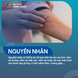 Nguyên nhân phổ biến của ngứa da bao gồm phản ứng dị ứng và da khô