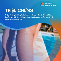 Triệu chứng nổi mề đay với những mảng phát ban đỏ trên da