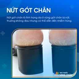 Nứt Gót Chân 1
