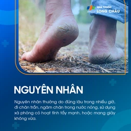 Nứt Gót Chân 3