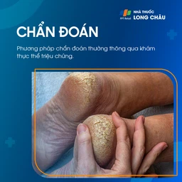 Nứt Gót Chân 5