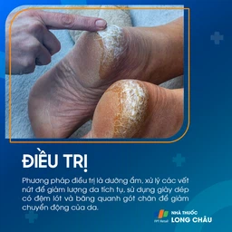 Nứt Gót Chân 6