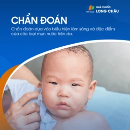 Rôm Sảy 5