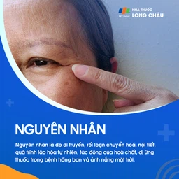 Sạm da 3
