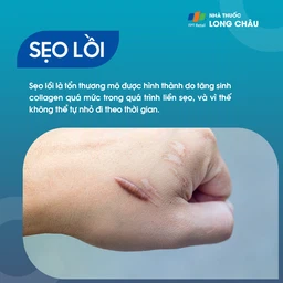 Sẹo Lồi 1