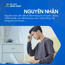 Nguyên nhân gây bệnh tổ đỉa có thể do di truyền, phản ứng miễn dịch thái quá, hoặc tác động từ môi trường