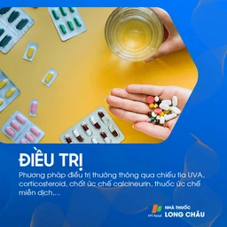 Điều trị bệnh tổ đỉa bằng cách sử dụng kem bôi steroid để giảm viêm và ngứa