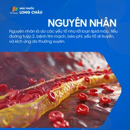 U Mềm Treo 3
