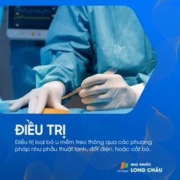U Mềm Treo 6