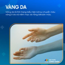Vàng Da 1