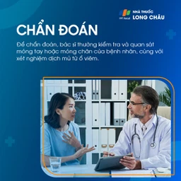 Viêm Quanh Móng 5