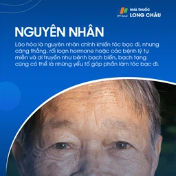 Tóc bạc sớm 3