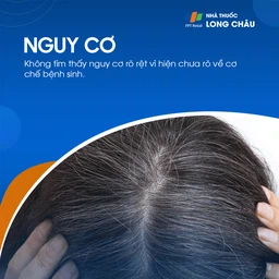 Tóc bạc sớm 4