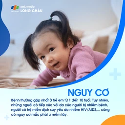 U mềm lây 4