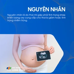 Hội chứng hít phân su 3