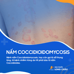 Bệnh nấm coccidioimycosis 1