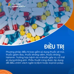 Viêm xoang trán 6