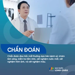 Đau hốc mắt 5