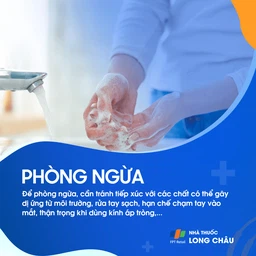 Ngứa mắt 7