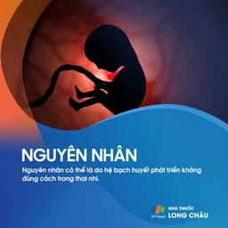 U bạch huyết 3