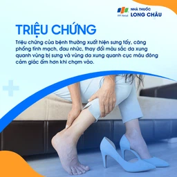 Viêm tắc tĩnh mạch 2