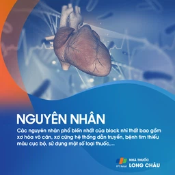 Block nhĩ thất 3