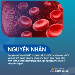 Tăng áp phổi 3