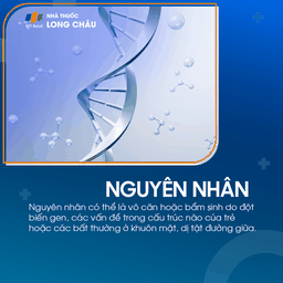 Lùn tuyến yên 4
