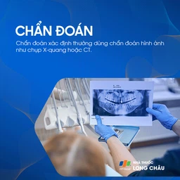 Răng thừa 5