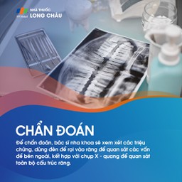 Răng mọc kẹt 5