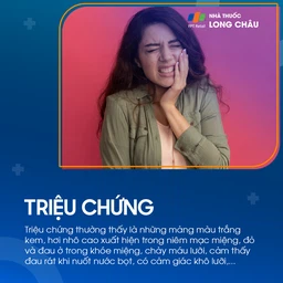 Tưa miệng 2