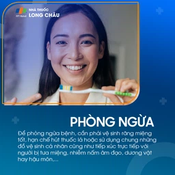 Tưa miệng 7