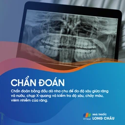 Tụt lợi 5