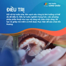 Tụt lợi 6