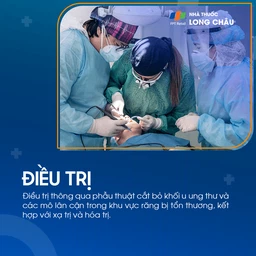 Ung thư răng 6