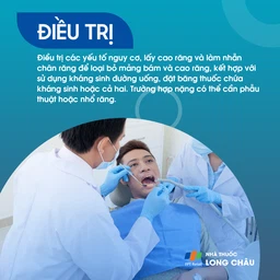 Viêm chân răng 6