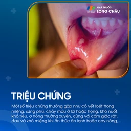 Viêm loét miệng triệu chứng