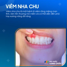 Viêm nha chu 1