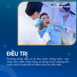 Viêm nha chu 6