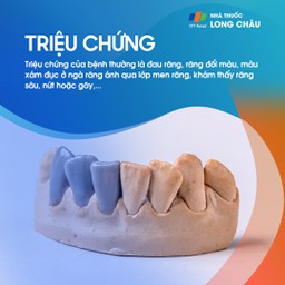 Viêm tủy răng 2