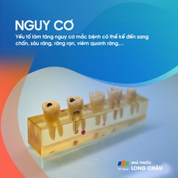 Viêm tủy răng 4