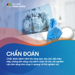 Viêm tủy răng 5