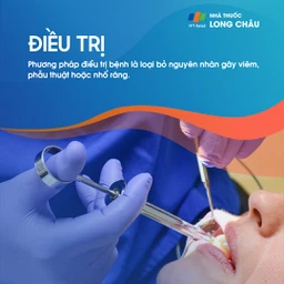 Viêm tủy răng 6