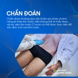 Tinh hoàn lạc chỗ 5