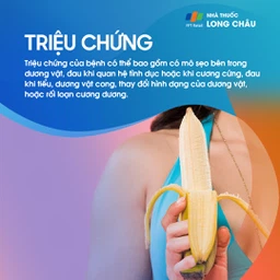Bệnh Peyronie 2