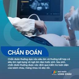 Dây rốn bám màng 5