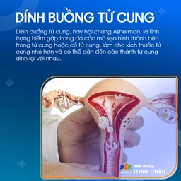 Dính buồng tử cung 1